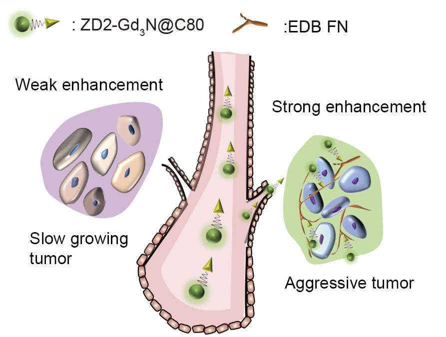 The illustration represents the concept of the work. The targeted contrast agent, ZD2-Gd3N@C80, binds to aggressive tumor and produces strong signal enhancement, but not in a slow-growing tumor, which allows detection and risk-stratification of breast cancer. 