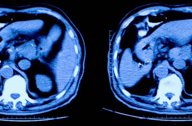 magnetic-resonance-imaging-archives-the-daily