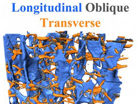 An illustration of the transverse struts in bone microarchitecture from the team's paper.