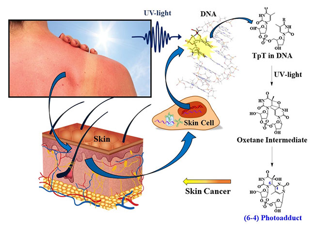 an illustration of how UV light causes pre-cancerous lesions on DNA