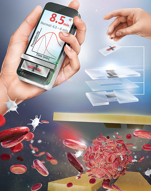 Smartphone app can vibrate a single drop of blood to determine how well it  clots